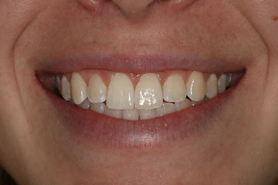 General Dental Care and Maintenance